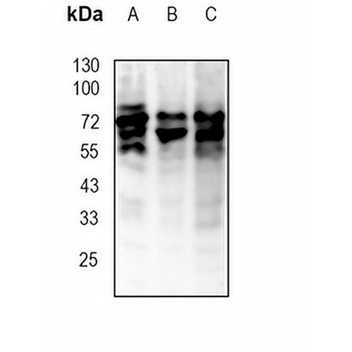 RYK Rabbit Monoclonal Antibody(C1911)