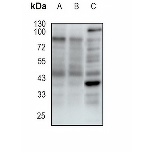 Napsin A Rabbit Monoclonal Antibody(C1917)