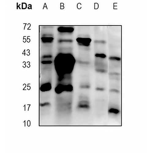 PRTN3 Rabbit Monoclonal Antibody(C1918)