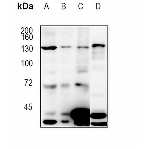 Jumonji Rabbit Monoclonal Antibody(C1919)