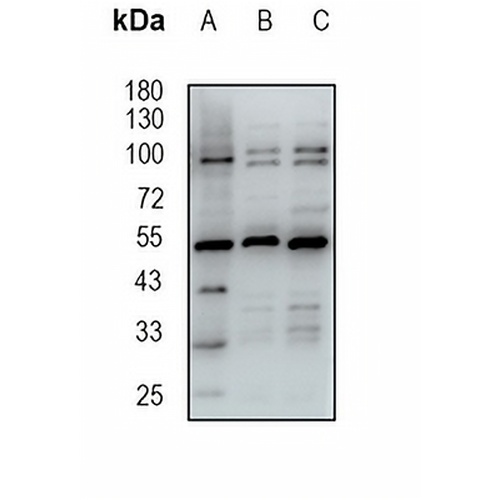 FKBP5 Rabbit Monoclonal Antibody(C1921)