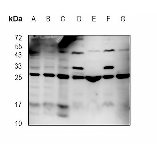 HPCA Rabbit Monoclonal Antibody(C1922)