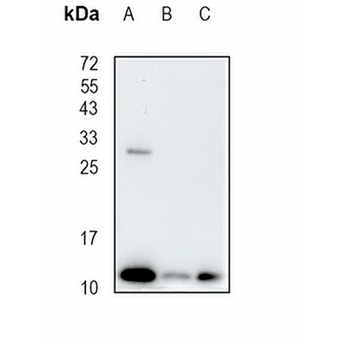 Cystatin A Rabbit Monoclonal Antibody(C1923)