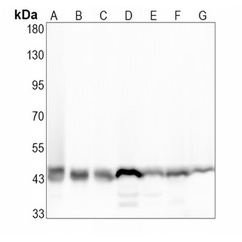 HDJ2 Rabbit Monoclonal Antibody(C1925)