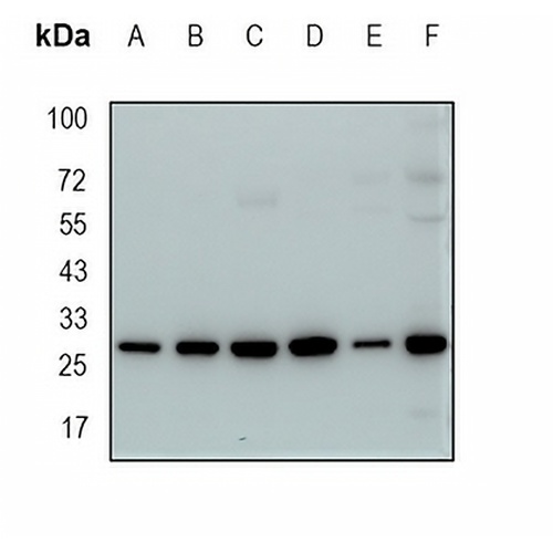 PGAM1 Rabbit Monoclonal Antibody(C1927)