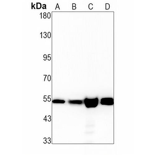 ERR gamma Rabbit Monoclonal Antibody(C1928)