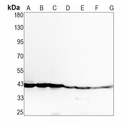 CD185 Rabbit Monoclonal Antibody(C1929)