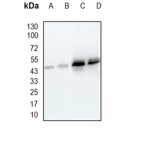 DDB2 Rabbit Monoclonal Antibody(C1930)