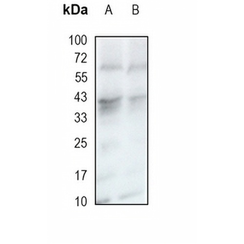 CRKL Rabbit Monoclonal Antibody(C1931)
