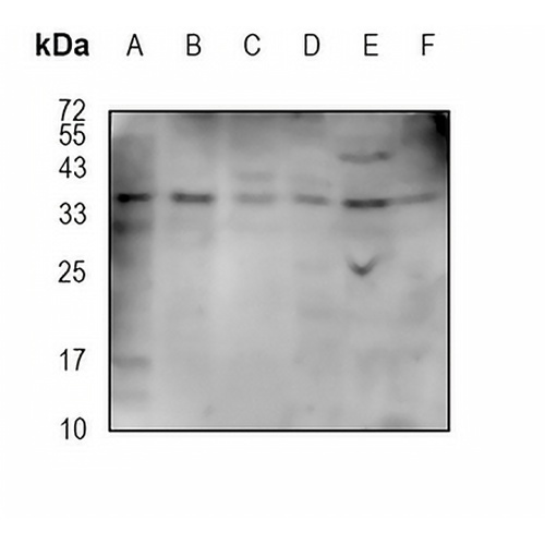 CRX Rabbit Monoclonal Antibody(C1933)
