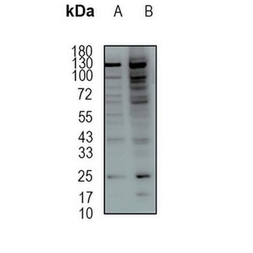 GSTK1 Rabbit Monoclonal Antibody(C1936)
