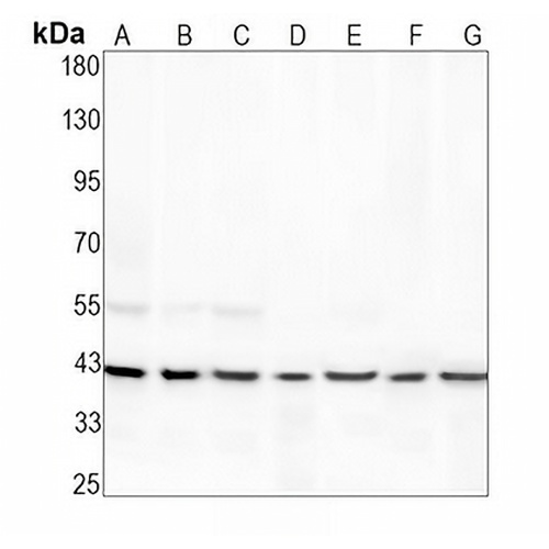 CCT alpha Rabbit Monoclonal Antibody(C1938)