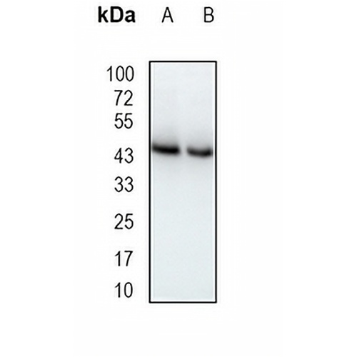 PRKAR2A Rabbit Monoclonal Antibody(C1940)
