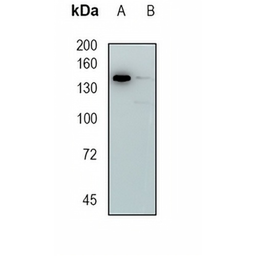 Timeless Rabbit Monoclonal Antibody(C1941)