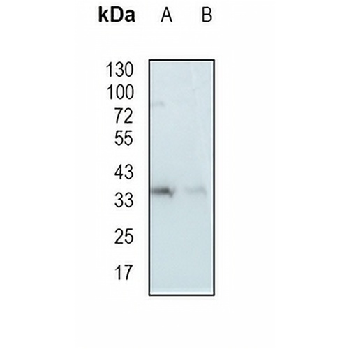 Tim50 Rabbit Monoclonal Antibody(C1942)