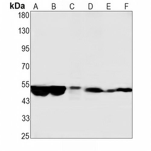 IgG1 Rabbit Monoclonal Antibody(C1944)