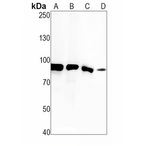 TAB3 Rabbit Monoclonal Antibody(C1945)
