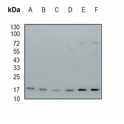 ARF5 Rabbit Monoclonal Antibody(C1946)