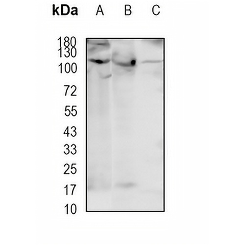 SART1 Rabbit Monoclonal Antibody(C1947)