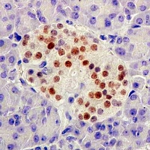 NKX2.2 Rabbit Monoclonal Antibody(C1951)