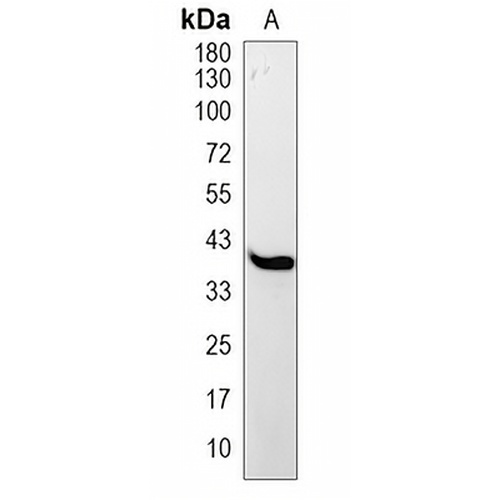 MCL1 Rabbit Monoclonal Antibody(C1952)