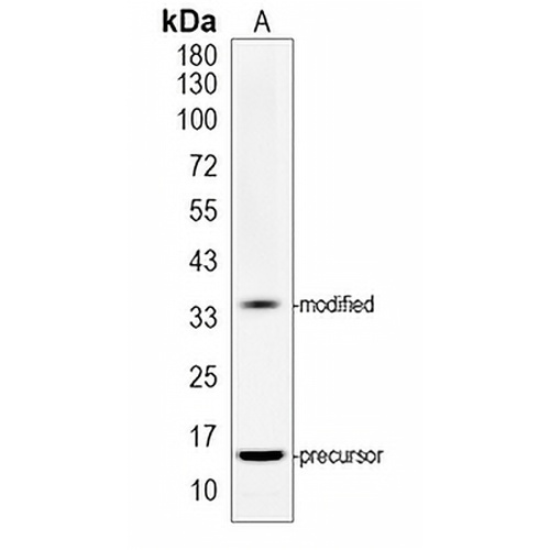 Ly6g Rabbit Monoclonal Antibody(C1960)