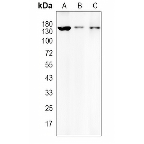 HDAC4 Rabbit Monoclonal Antibody(C1961)