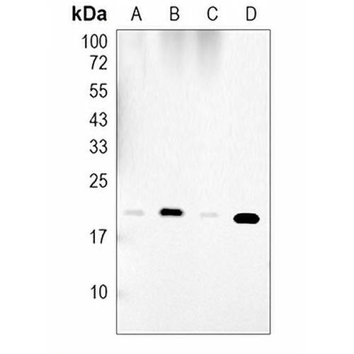 IL-10 Rabbit Monoclonal Antibody(C1963)