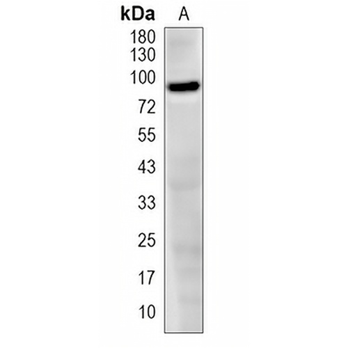 MDM2 Rabbit Monoclonal Antibody(C1964)