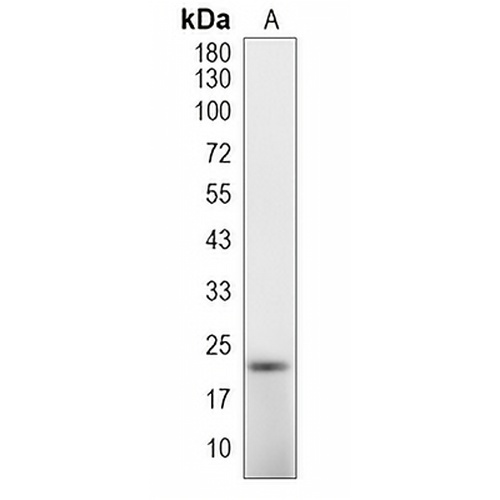 CD90  Rabbit Monoclonal Antibody(C1965)