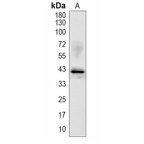 TPST2  Rabbit Monoclonal Antibody(C1966)