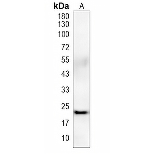 IL18 Rabbit Monoclonal Antibody(C1967)