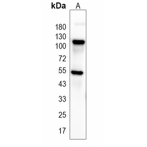 NF-kappaB p105/p50 Rabbit Monoclonal Antibody(C1969)