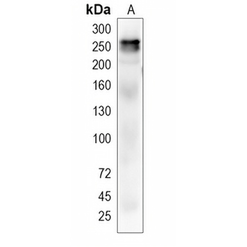 ACACB Rabbit Monoclonal Antibody(C1970)