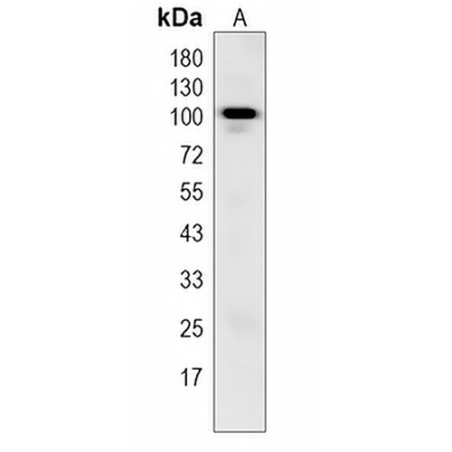 FAM160A2 Rabbit Monoclonal Antibody(C1973)
