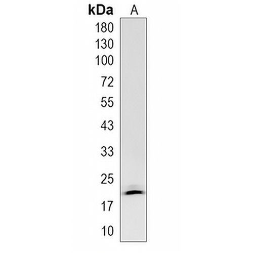 NUP62CL Rabbit Monoclonal Antibody(C1975)