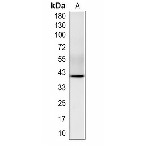RBM43 Rabbit Monoclonal Antibody(C1976)