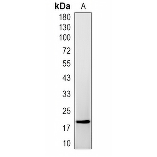 PPIL1 Rabbit Monoclonal Antibody(C1978)