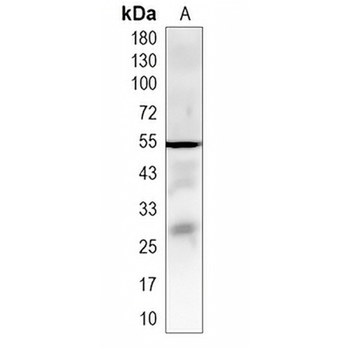PTDSS2 Rabbit Monoclonal Antibody(C1980)