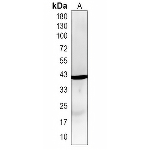 UPB1 Rabbit Monoclonal Antibody(C1981)