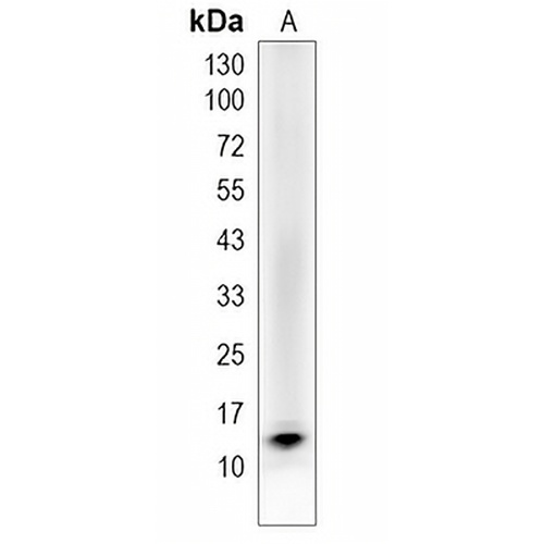 PDZK1IP1 Rabbit Monoclonal Antibody(C1982)