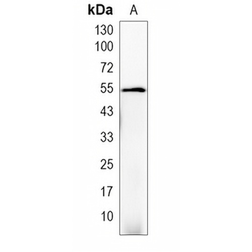 KRT83 Rabbit Monoclonal Antibody(C1984)
