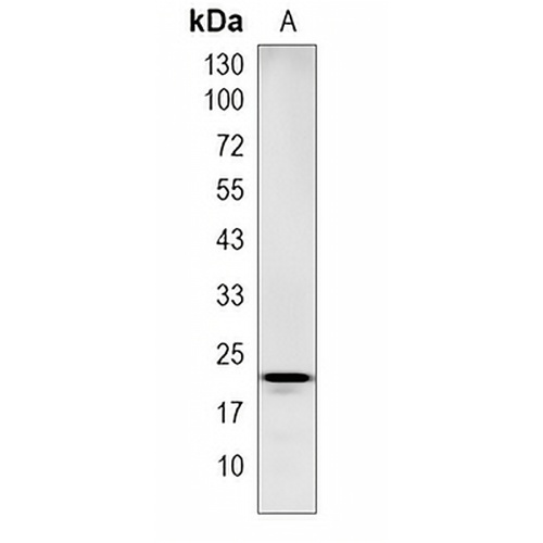 VSTM5 Rabbit Monoclonal Antibody(C1987)