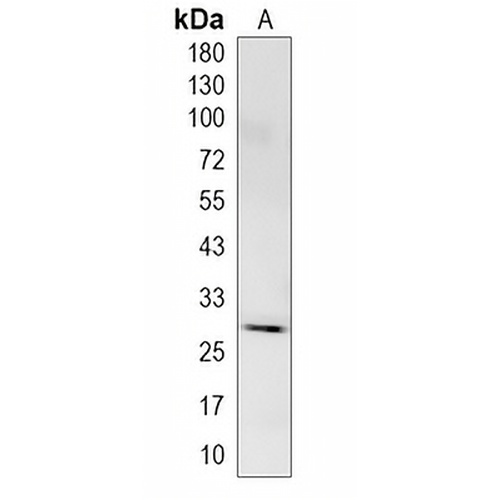 KCTD21 Rabbit Monoclonal Antibody(C1989)