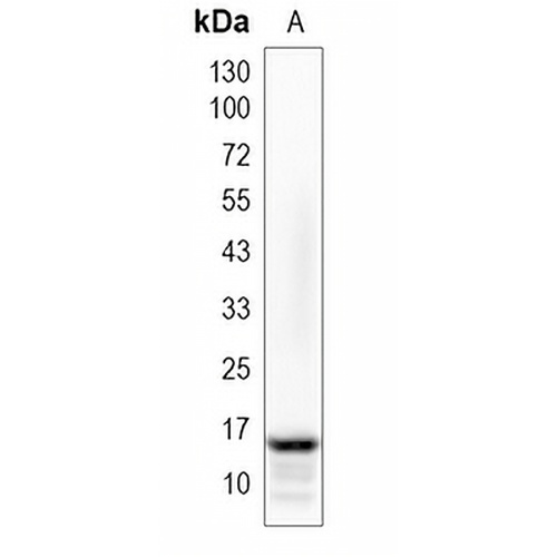 LGALS14 Rabbit Monoclonal Antibody(C1990)