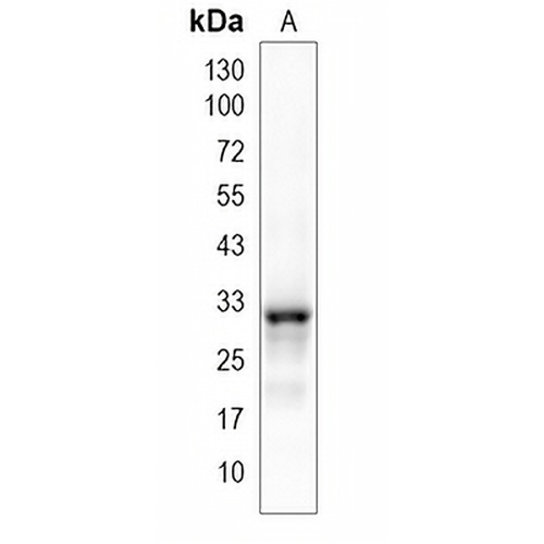 C15orf41 Rabbit Monoclonal Antibody(C1991)
