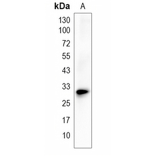C1QTNF2 Rabbit Monoclonal Antibody(C1992)