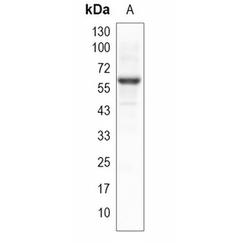ABHD16A Rabbit Monoclonal Antibody(C1993)