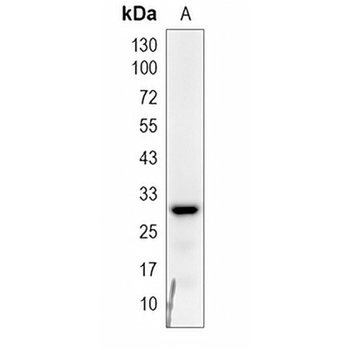 SLC25A26 Rabbit Monoclonal Antibody(C1994)