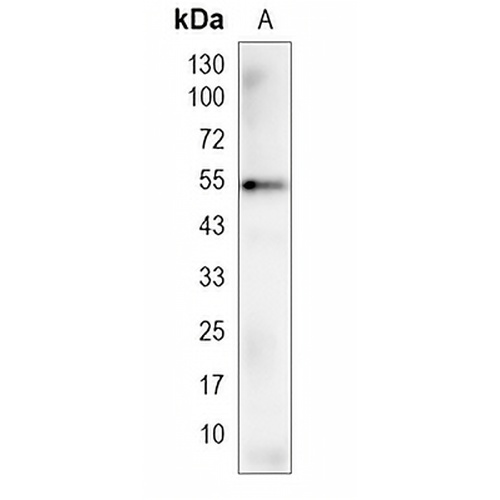 TMEM161B Rabbit Monoclonal Antibody(C1995)